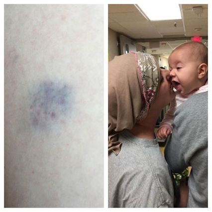 June 8 2016 Hospital Admit